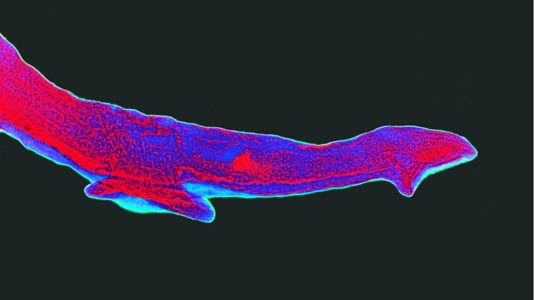 The Truth Behind Viral ‘Parasite Cleanses’: Experts Weigh In